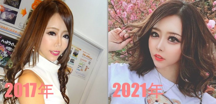整形とミーアイ時代の比較画像