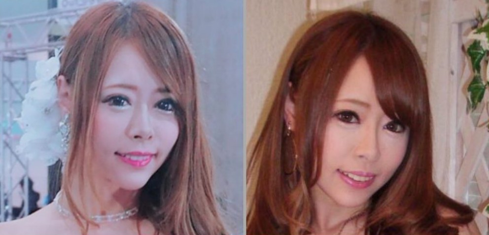 整形に関する本人の告白まとめ